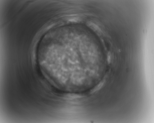 X0000088140339200706041341