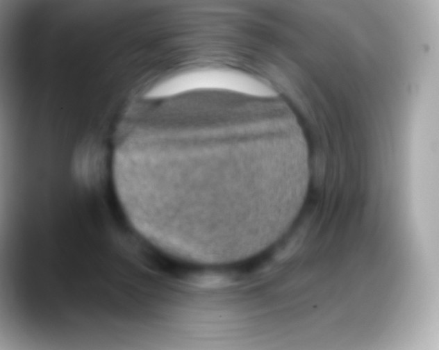 X0000088140356200706041341