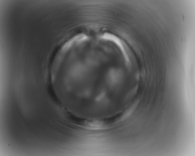 X0000088140359200706041341