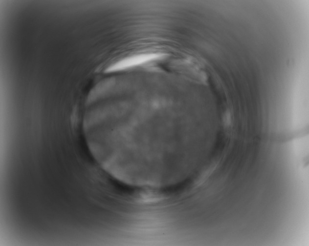 X0000088140372200706041341