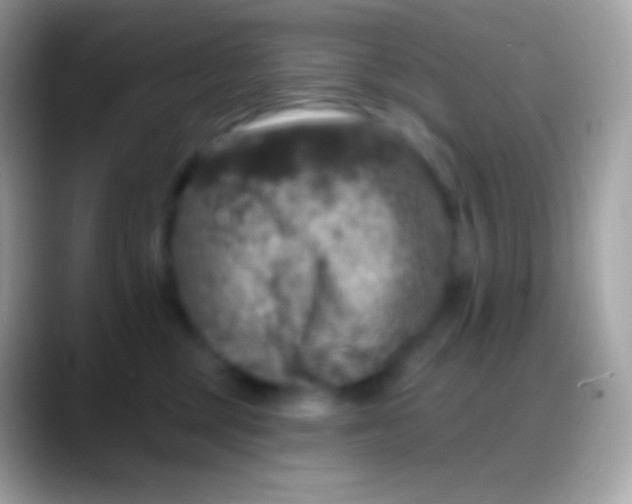 X0000088140377200706041341