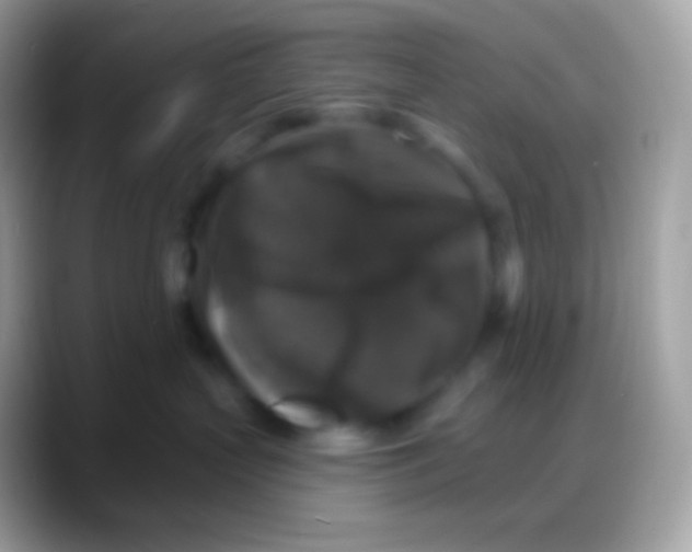 X0000088140383200706041341