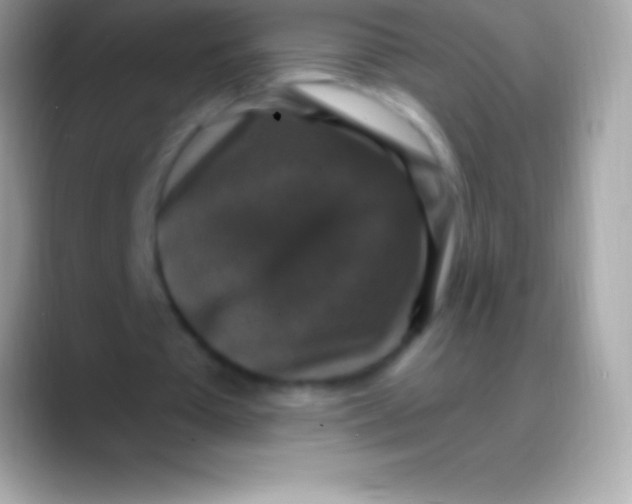 X0000088140385200706041341