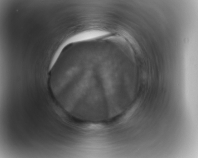 X0000088140401200706041341