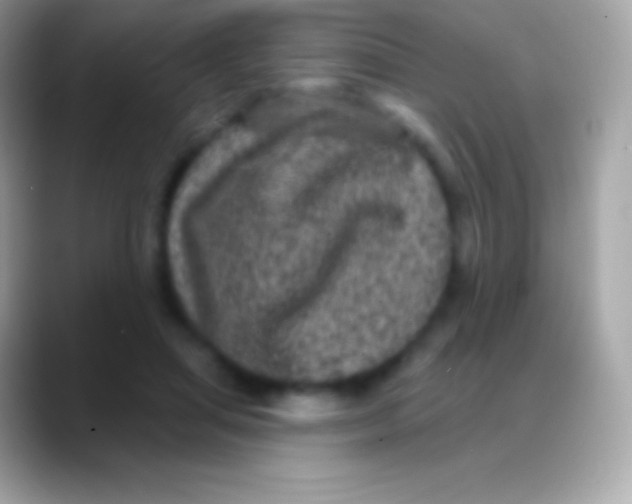 X0000088140455200706041340