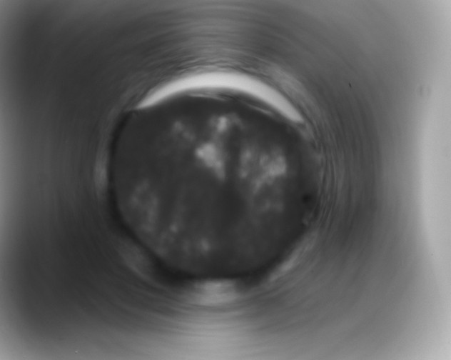 X0000088140501200706041339