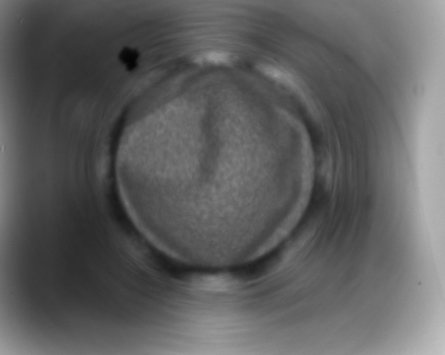 X0000088140548200706041339