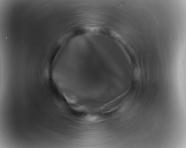 X0000088140570200706041339