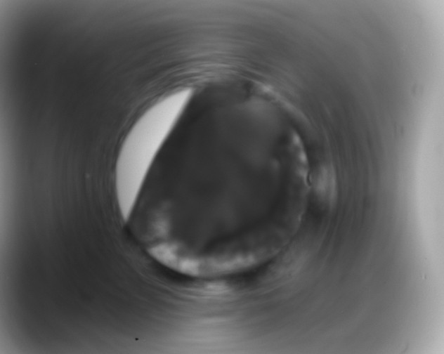 X0000088140715200706041337