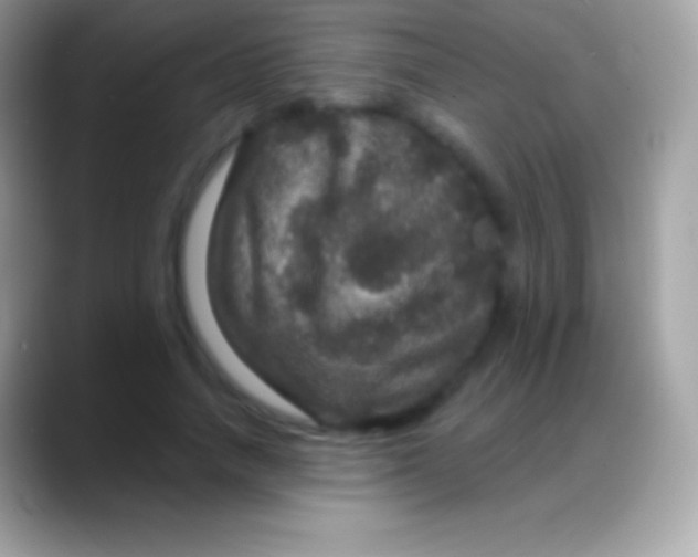 X0000088140738200706041336