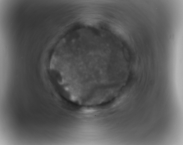 X0000088140817200706041335