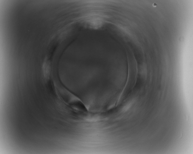 X0000088140818200706041335