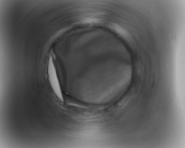 X0000088140872200706041335