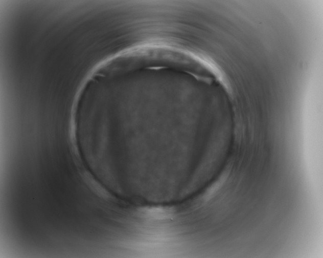 X0000088140896200706041335