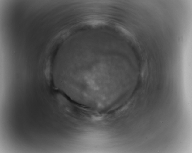 X0000088141014200706041333