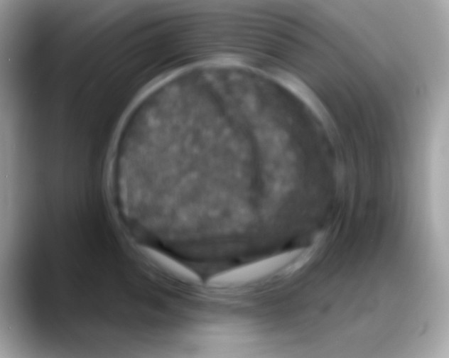 X0000088141052200706041333