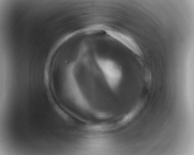 X0000088141054200706041333