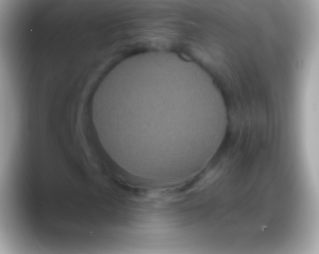 X0000088141057200706041333