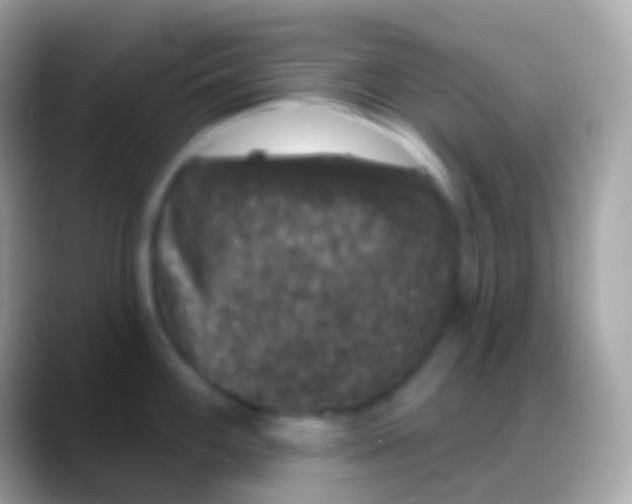 X0000088141100200706041332