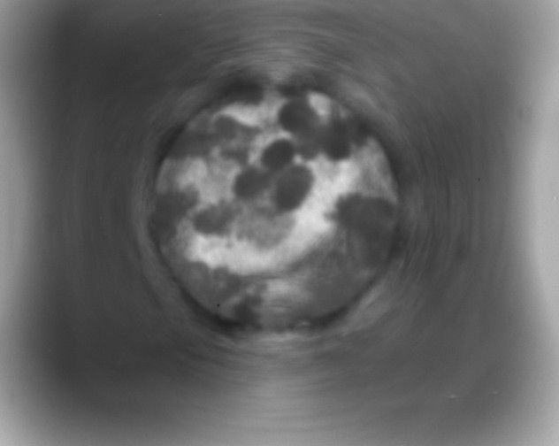 X0000088141105200706041332