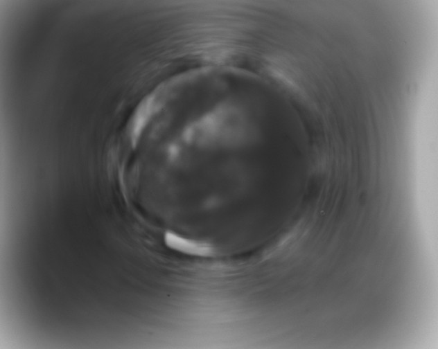 X0000088141106200706041332