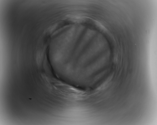 X0000088141108200706041332