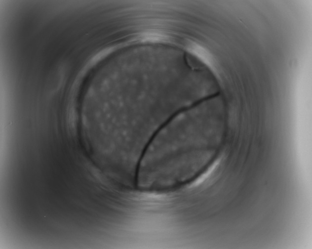 X0000088141115200706041332