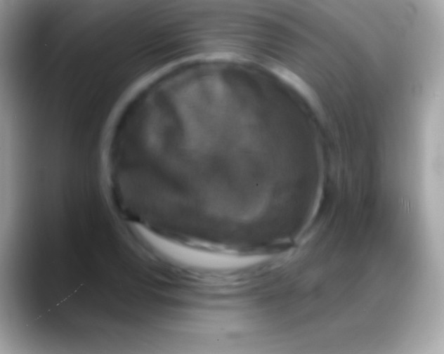 X0000088141120200706041332