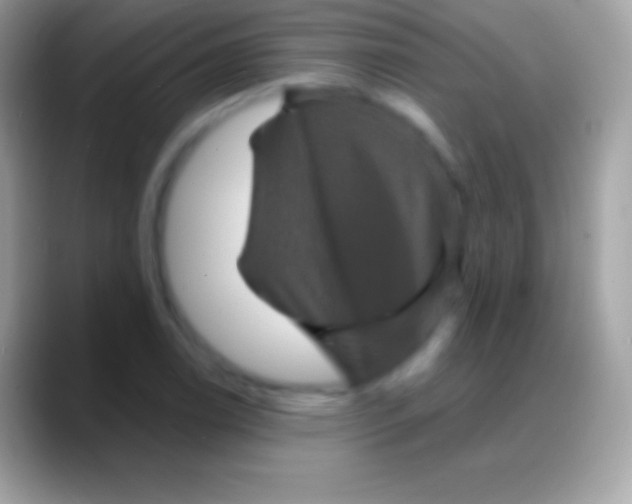 X0000088141122200706041332