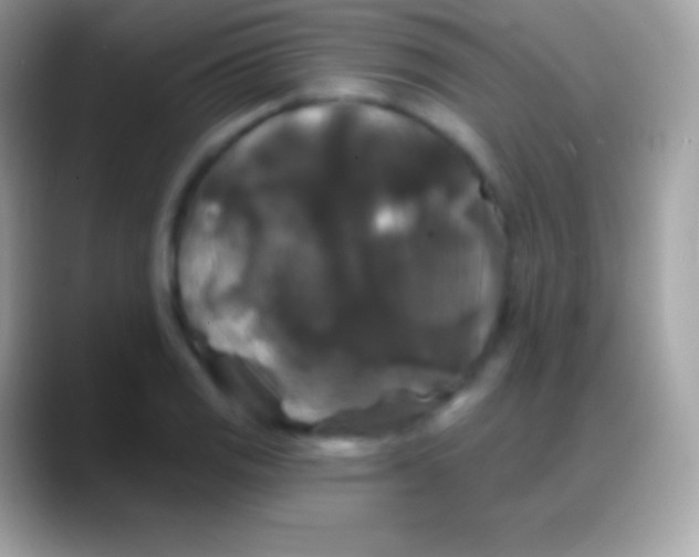 X0000088141125200706041332