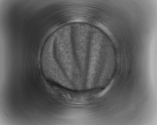 X0000088141129200706041332