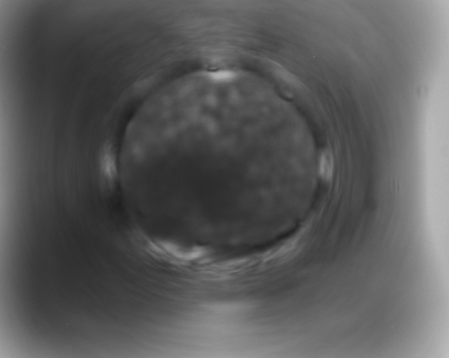 X0000088141155200706041332