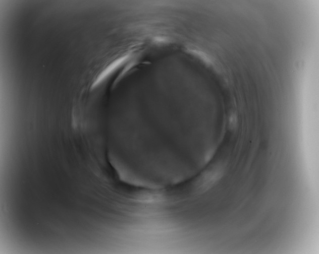 X0000088141156200706041332