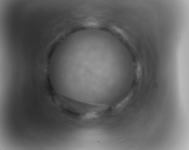 X0000088141157200706041332