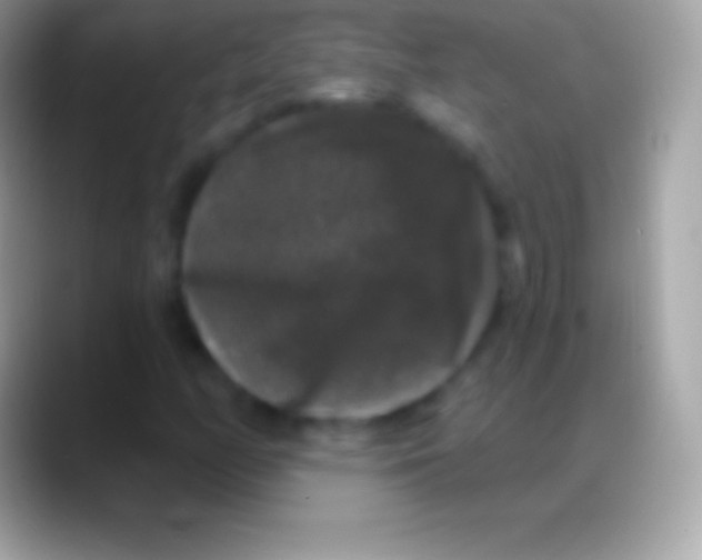 X0000088141158200706041332