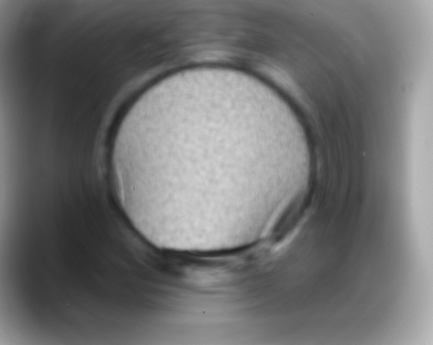 X0000088141164200706041332