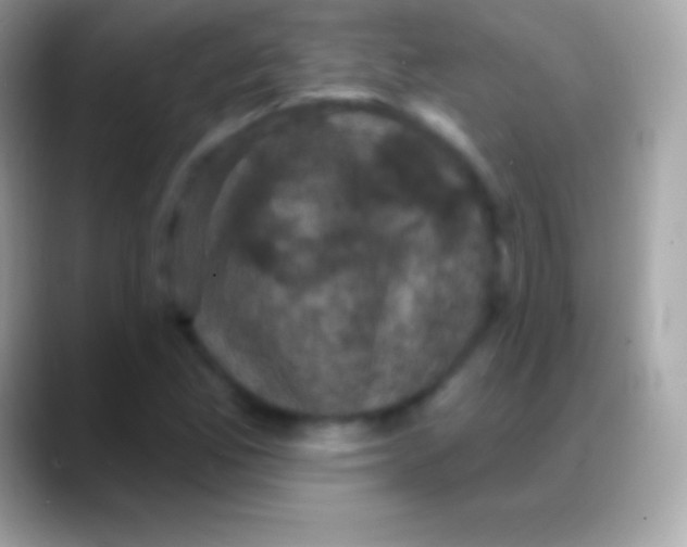 X0000088141165200706041332