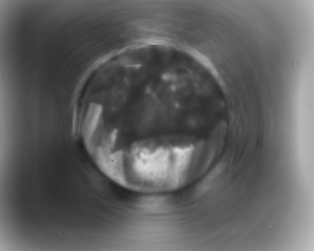 X0000088141171200706041332