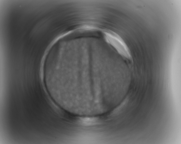 X0000088141195200706041331