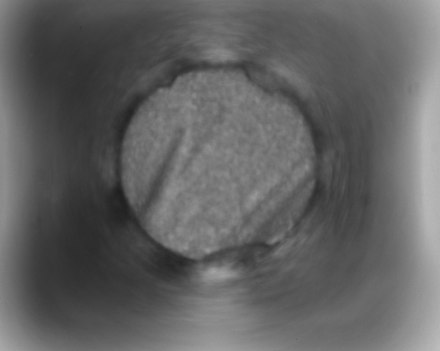 X0000088141205200706041331