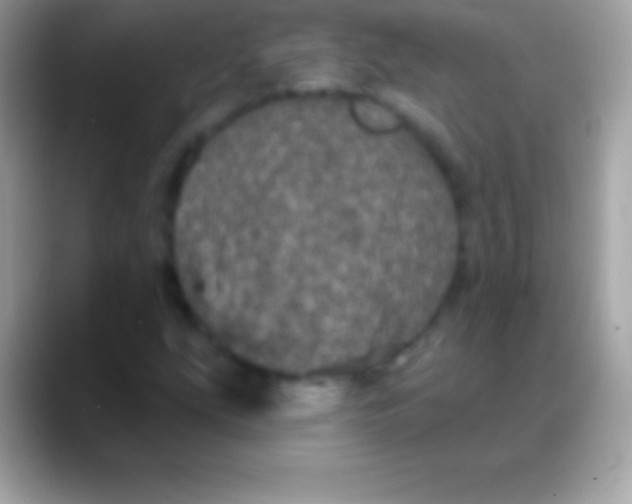 X0000088141207200706041331