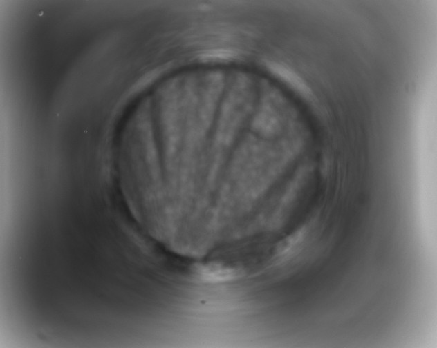 X0000088141208200706041331