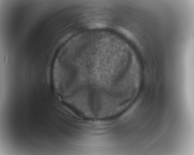 X0000088141217200706041331