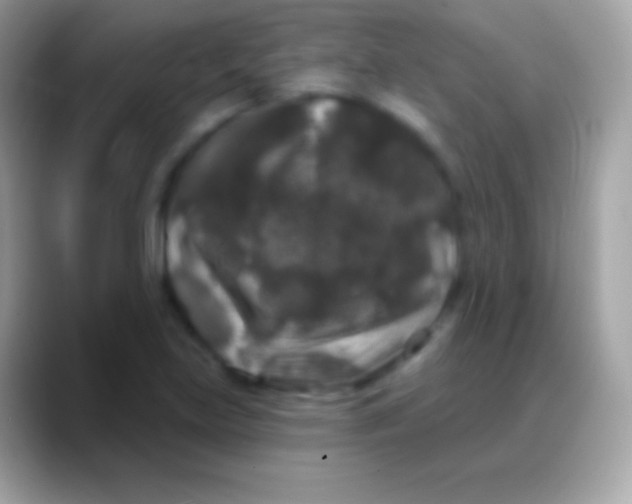 X0000088141219200706041331