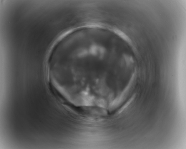 X0000088141223200706041331