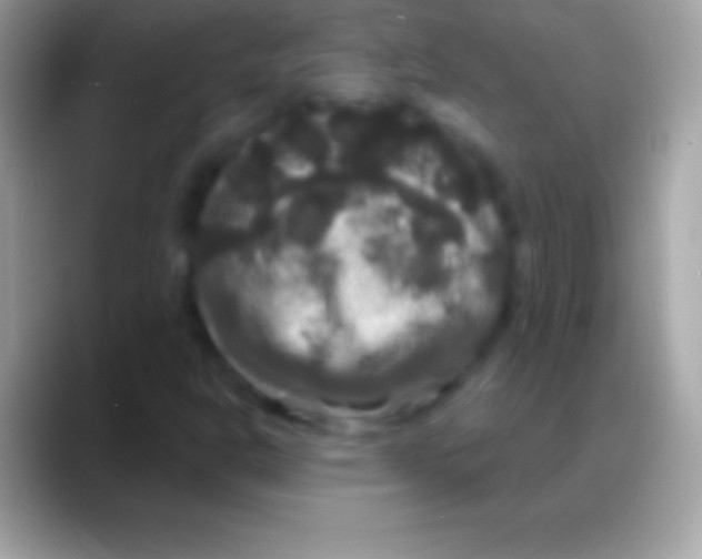 X0000088141302200706041330