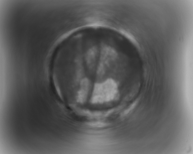 X0000088141311200706041330