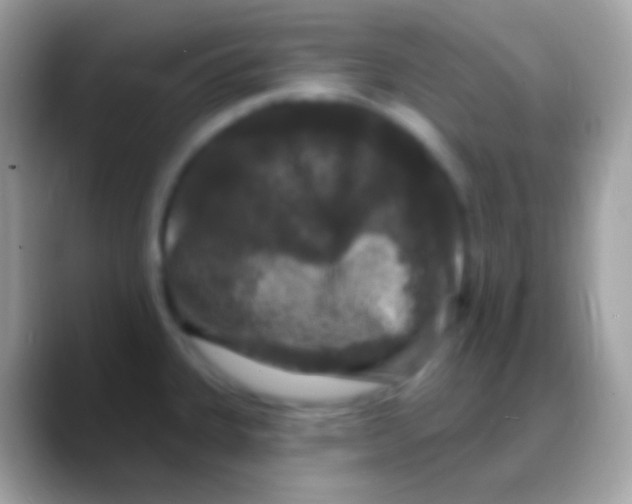 X0000088141335200706041330