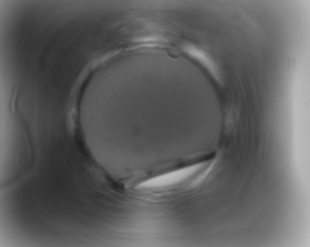 X0000088141357200706041329