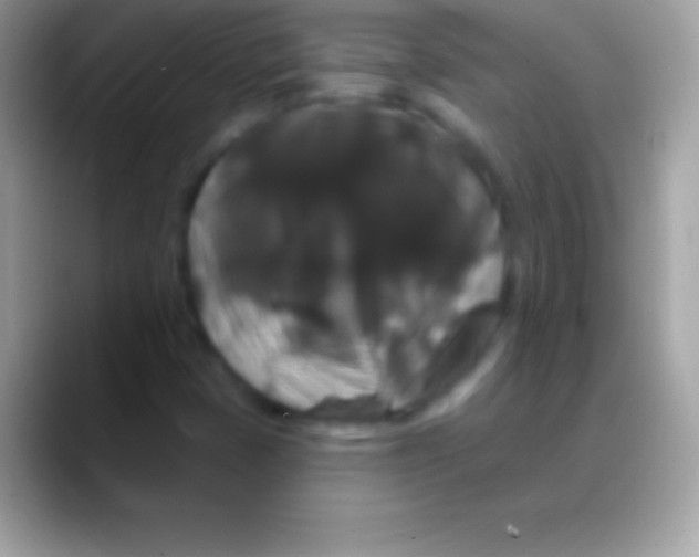 X0000088141401200706041329